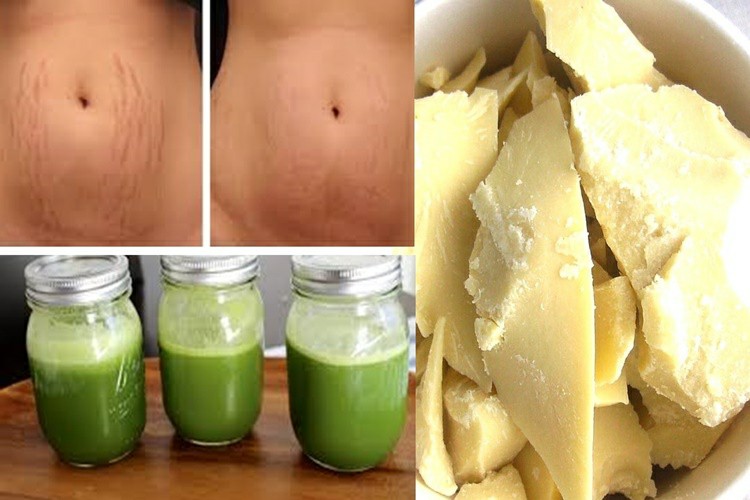 Receita Natural Para Remover Estrias em Casa (Passo a Passo)